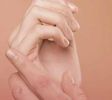 ePsA-Screening für Patienten background