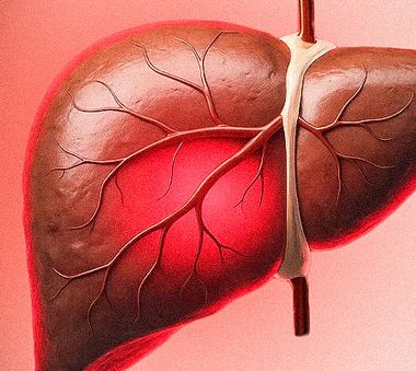 Nicht-alkoholische steatohepatitis